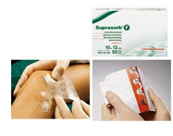 MEDICAZIONE STERILE IN FILM IN POLIURETANO TRASP. SUPRASORB F 10X12CM 10 PEZZI - Pharmaleader