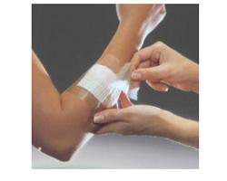 FILM ADESIVO IN POLIURETANO OPSITE FLEXIFIX IN ROTOLO TRASPARENTE IMPERMEABILE PER FISSAGGIO DI MEDICAZIONI E CATETERI LARGHEZZA 15 CM LUNGHEZZA 10 M 1 PEZZO - Pharmaleader